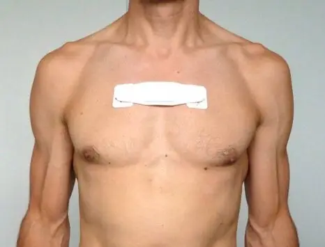 Discreet, high-performance cardiac monitor - Clinique Omicron