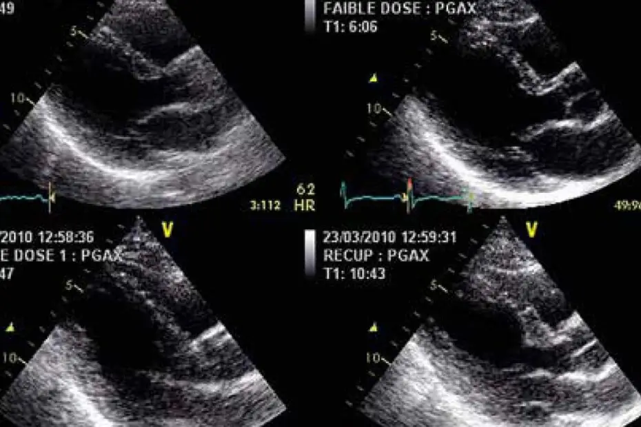 advanced imaging for a complete assessment of the heart - Clinique Omicron