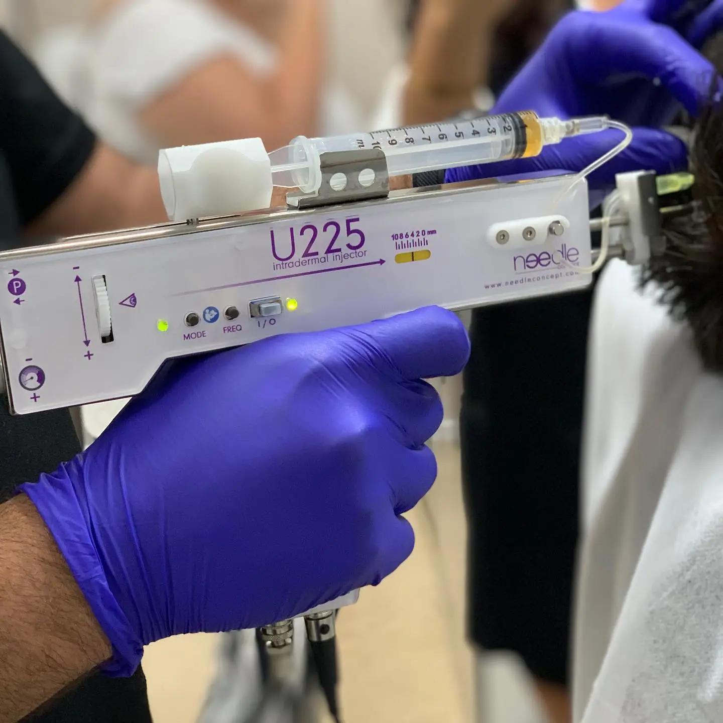 Injecteur intradermique U225 en action, utilisé pour des traitements esthétiques à la Clinique Omicron, avec main gantée de bleu et patient en arrière-plan.