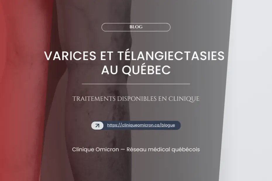 Varices et télangiectasies sur une jambe, mettant en évidence les traitements disponibles à la Clinique Omicron au Québec.