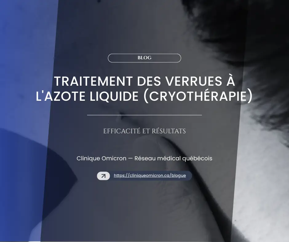 Traitement des verrues à l'azote liquide (cryothérapie) avec des résultats visibles et des informations sur l'efficacité à la Clinique Omicron.