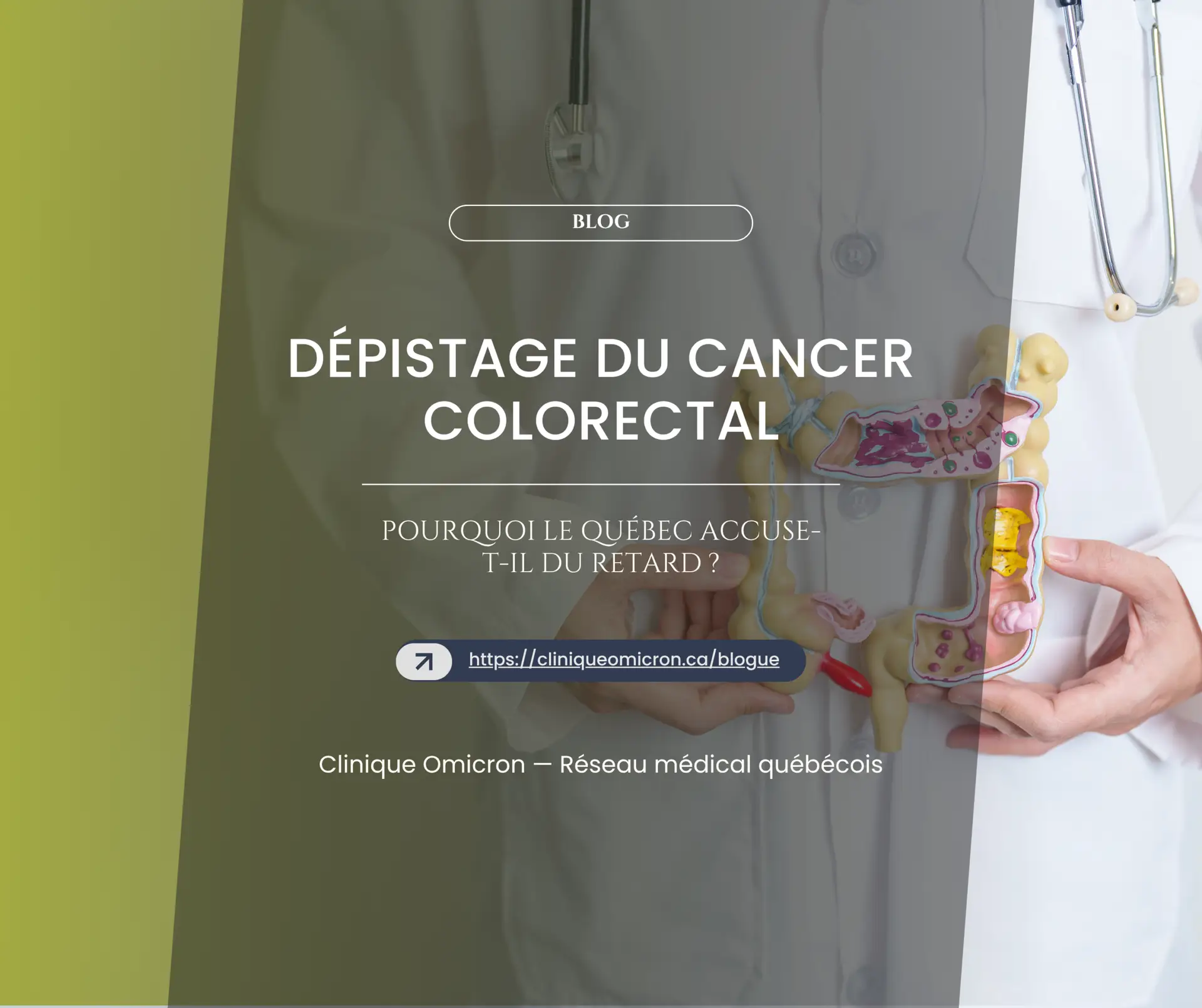 Mod&egrave;le de colon en plastique illustrant le d&eacute;pistage du cancer colorectal, avec texte sur l'importance de la sensibilisation &agrave; la sant&eacute; et au d&eacute;pistage, Clinique Omicron.