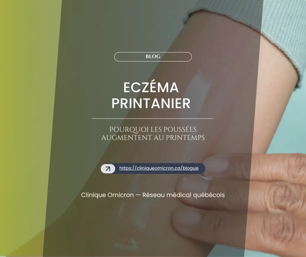 Application de cr&egrave;me sur la peau pour traiter l'ecz&eacute;ma printanier, avec titre de blog sur les pouss&eacute;es d'ecz&eacute;ma au printemps.