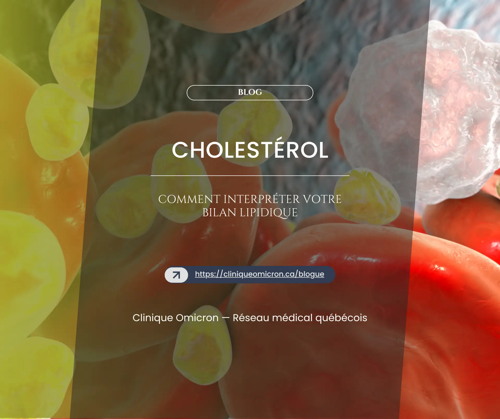 Image illustrant des cellules lipidiques en relation avec le cholest&eacute;rol, accompagn&eacute;e du titre "Cholest&eacute;rol : comment interpr&eacute;ter votre bilan lipidique" pour Clinique Omicron, r&eacute;seau m&eacute;dical qu&eacute;b&eacute;cois.