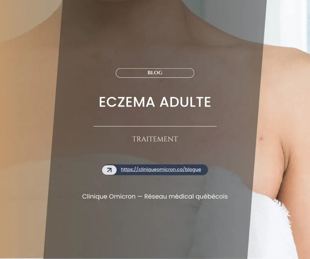 Image d'un adulte montrant des sympt&ocirc;mes d'ecz&eacute;ma, avec le texte "Ecz&eacute;ma Adulte" et des informations sur le traitement, Clinique Omicron.