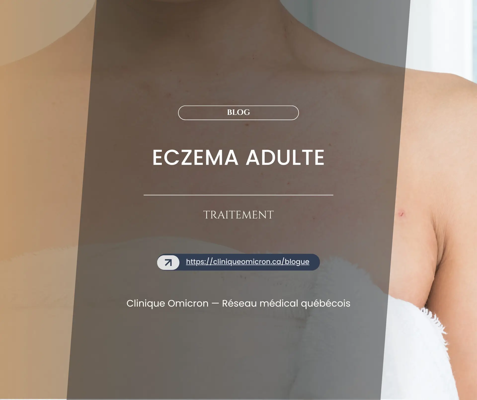 Image d'un adulte montrant des symptômes d'eczéma, avec le texte "Eczéma Adulte" et des informations sur le traitement, Clinique Omicron.