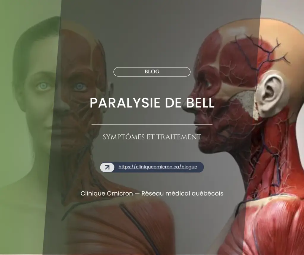 Mod&egrave;le anatomique illustrant la paralysie de Bell, mettant en &eacute;vidence les nerfs faciaux et les muscles du visage au Qu&eacute;bec.