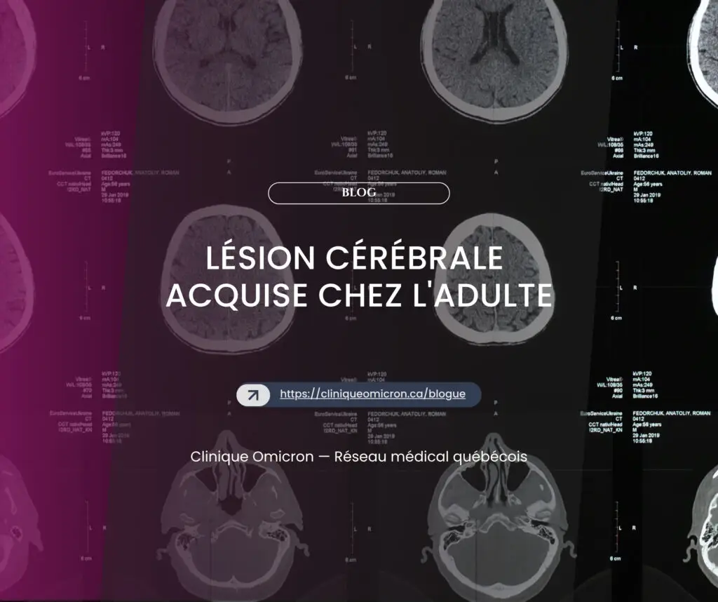 L&eacute;sion c&eacute;r&eacute;brale acquise chez l'adulte : r&eacute;cup&eacute;ration et r&eacute;adaptation