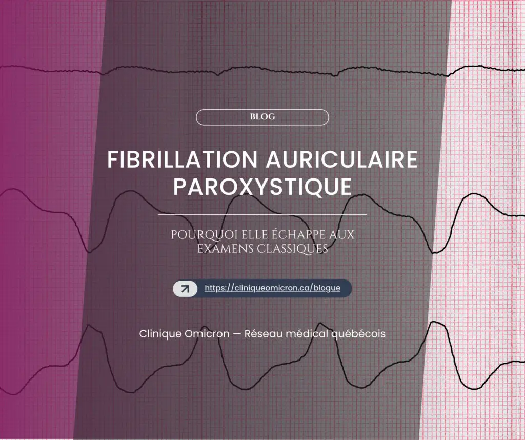 Fibrillation auriculaire paroxystique : pourquoi elle &eacute;chappe aux examens classiques