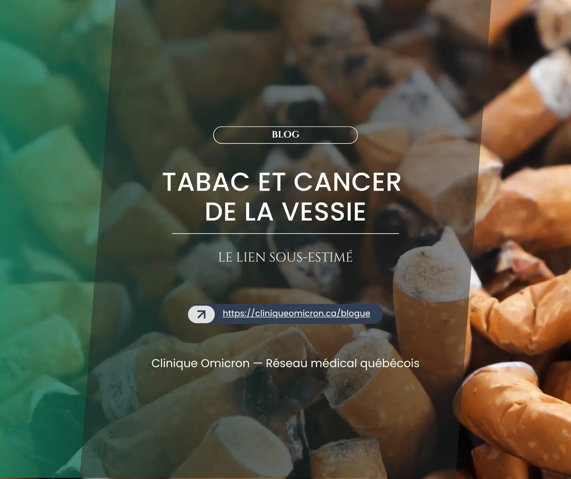 Tabac et cancer de la vessie : le lien sous-estimé