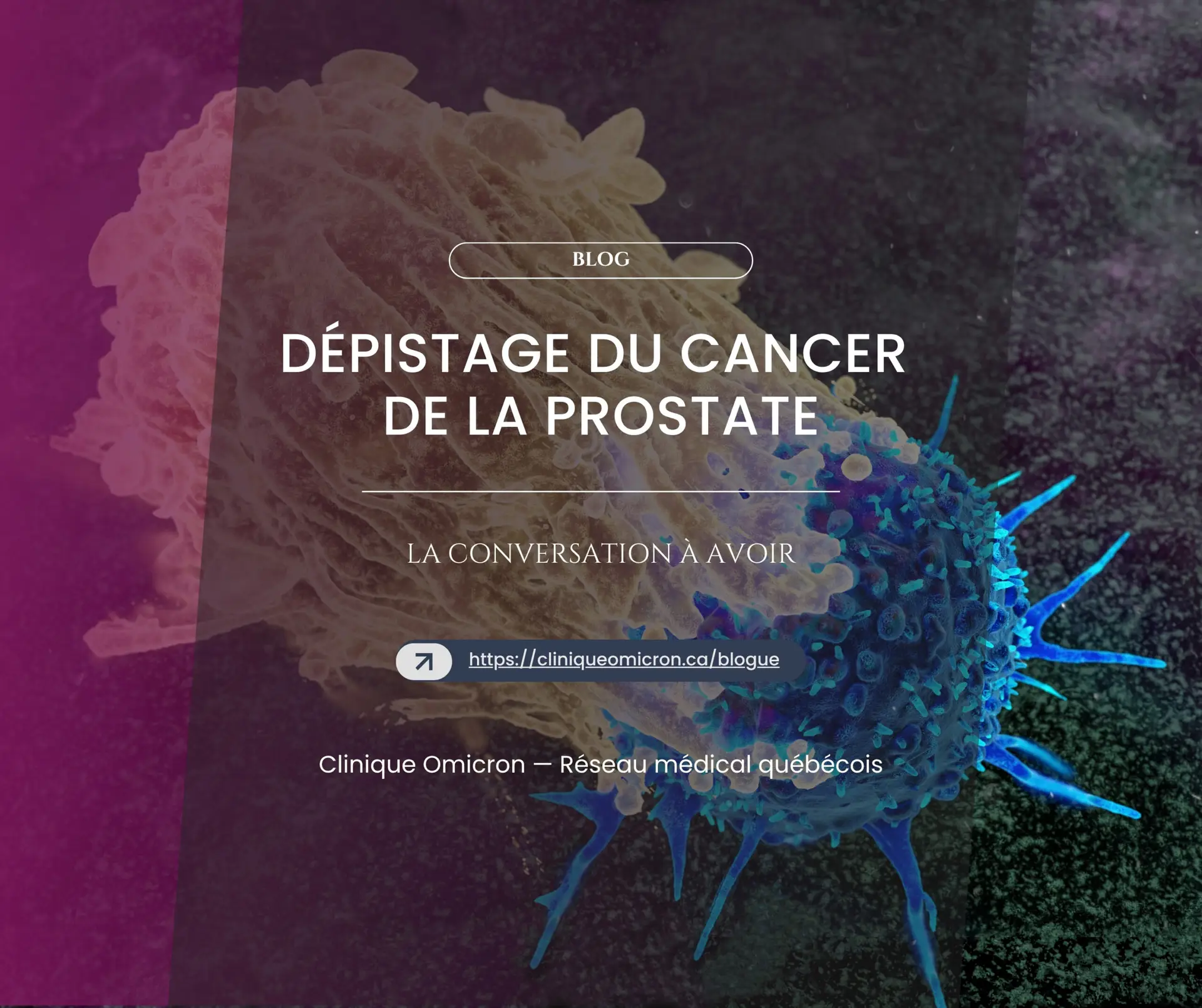 Dépistage du cancer de la prostate : la conversation à avoir