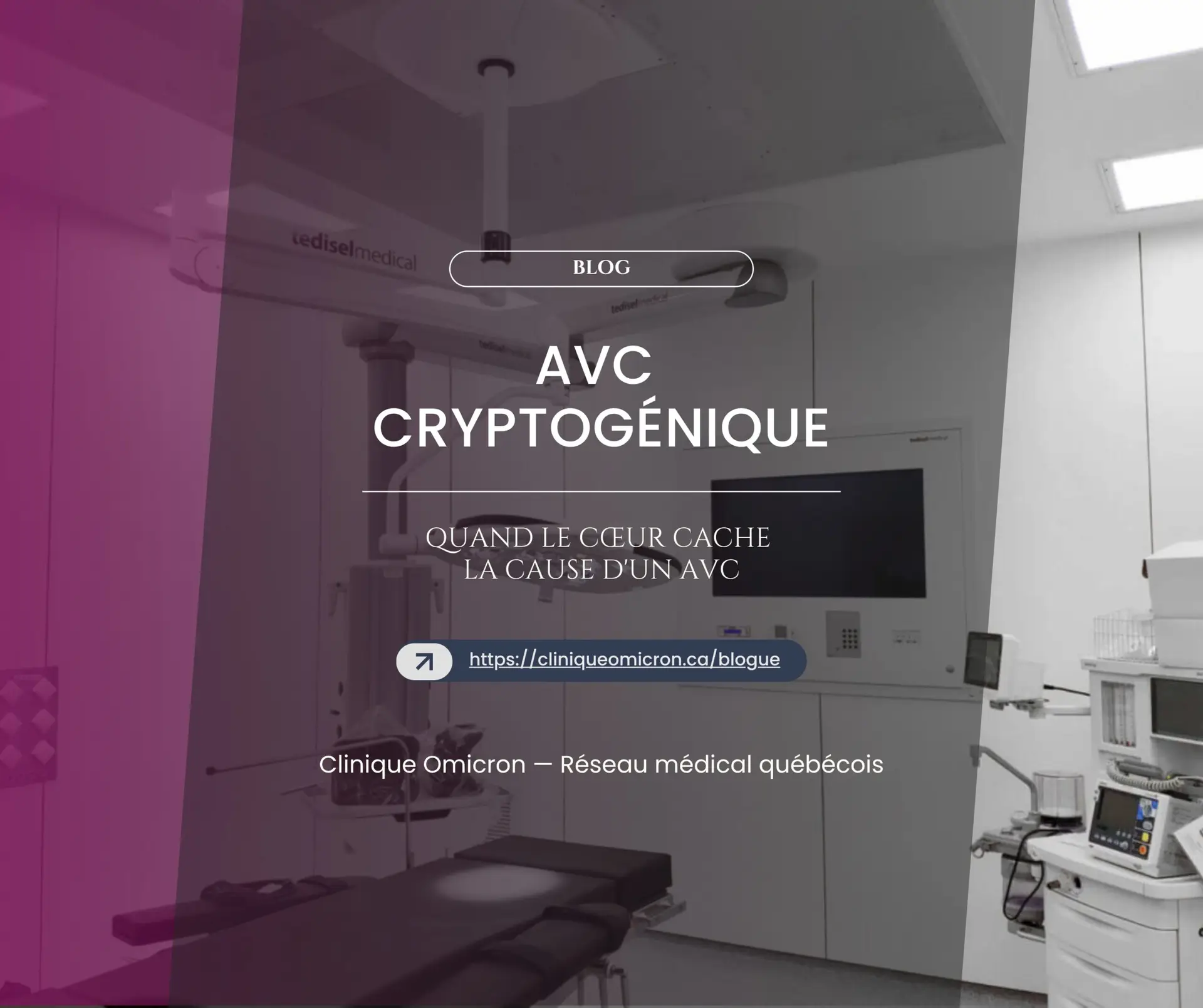 AVC cryptogénique : quand le cœur cache la cause d'un AVC