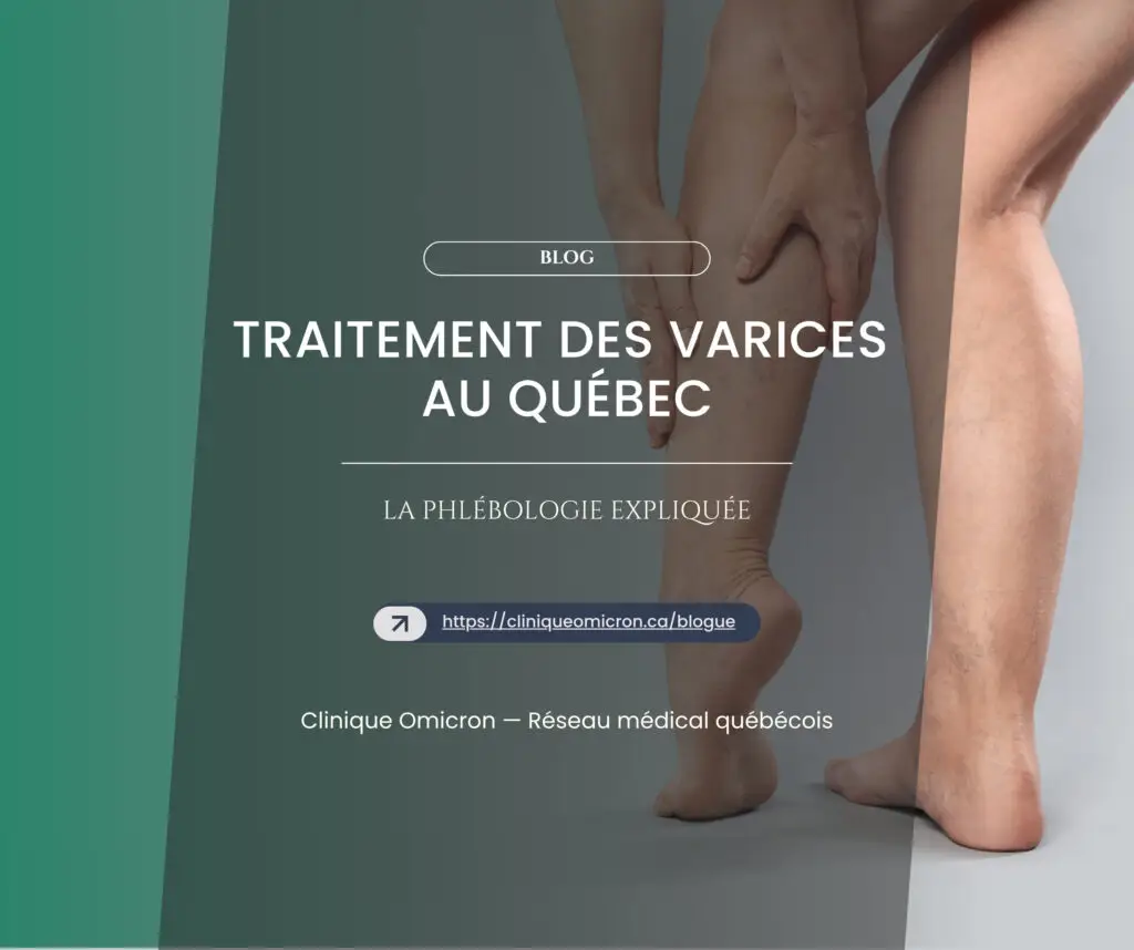 Traitement des varices au Qu&eacute;bec : la phl&eacute;bologie expliqu&eacute;e