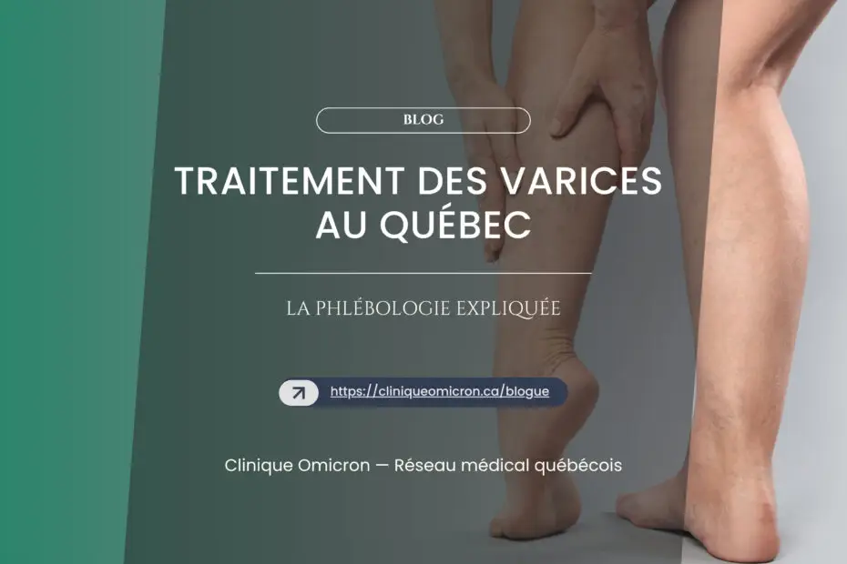 Vein Treatment in Quebec: Phlebology Explained