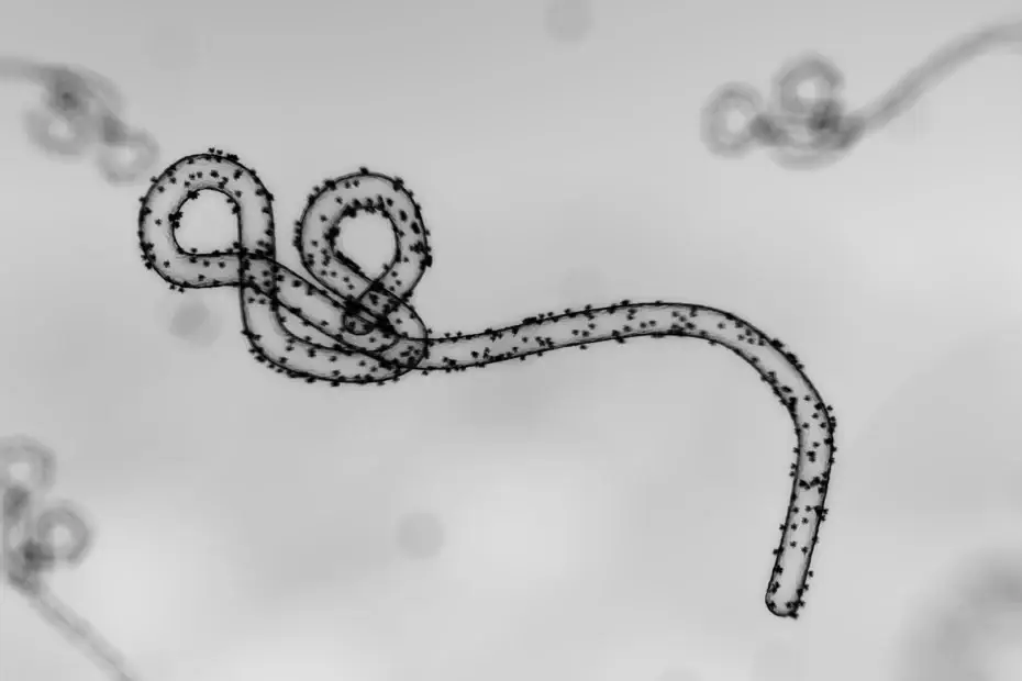 Grayscale micrograph of a long, filamentous virus with evenly spaced knobs, coiled in the foreground.