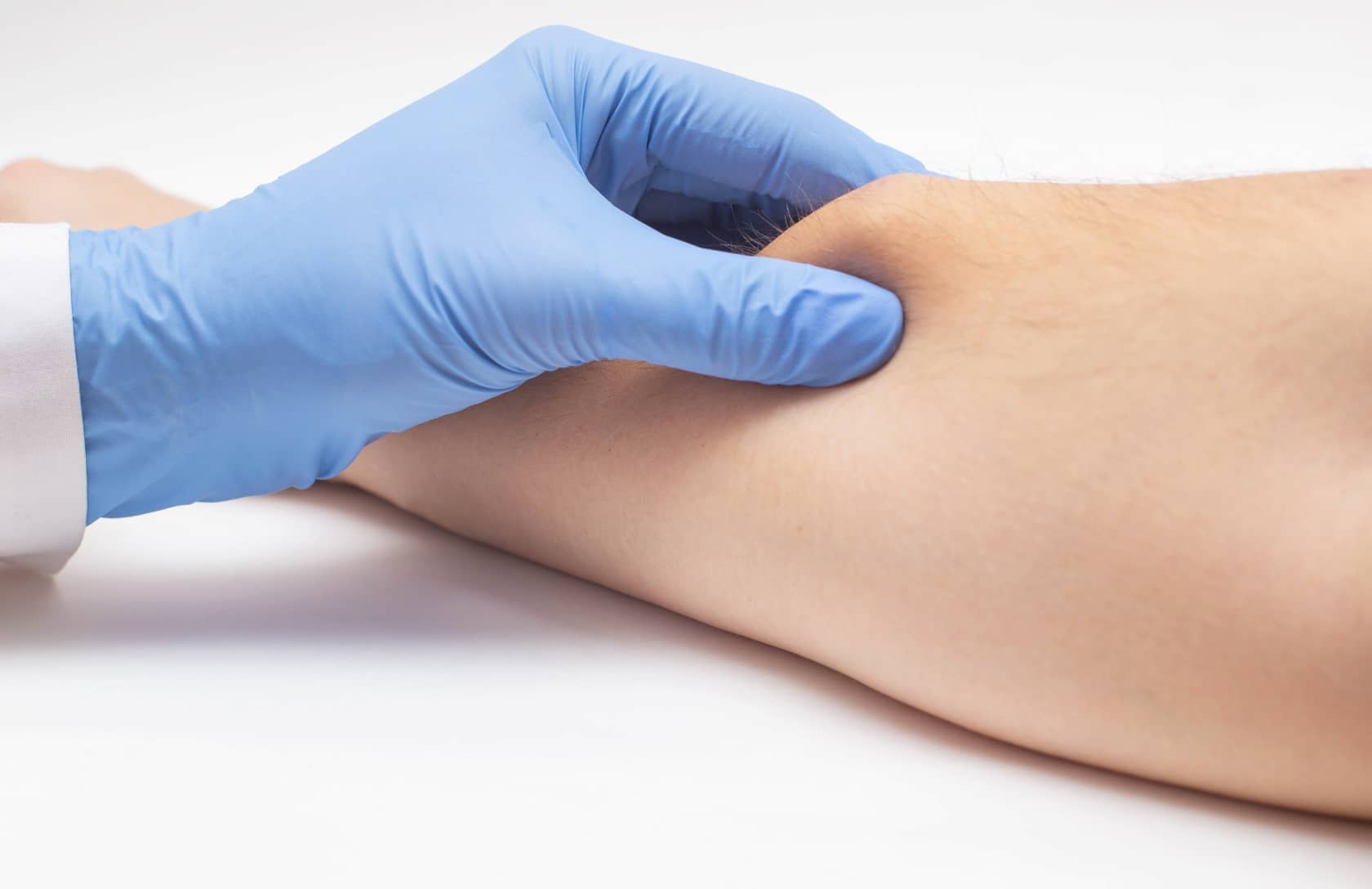Évaluation et excision chirurgicale d'un lipome à la Clinique Omicron au Québec